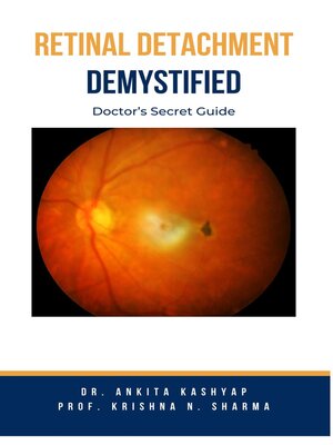 cover image of Retinal Detachment Demystified